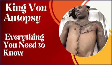 Discover The Shocking Truth: King Von's Autopsy Photos Revealed